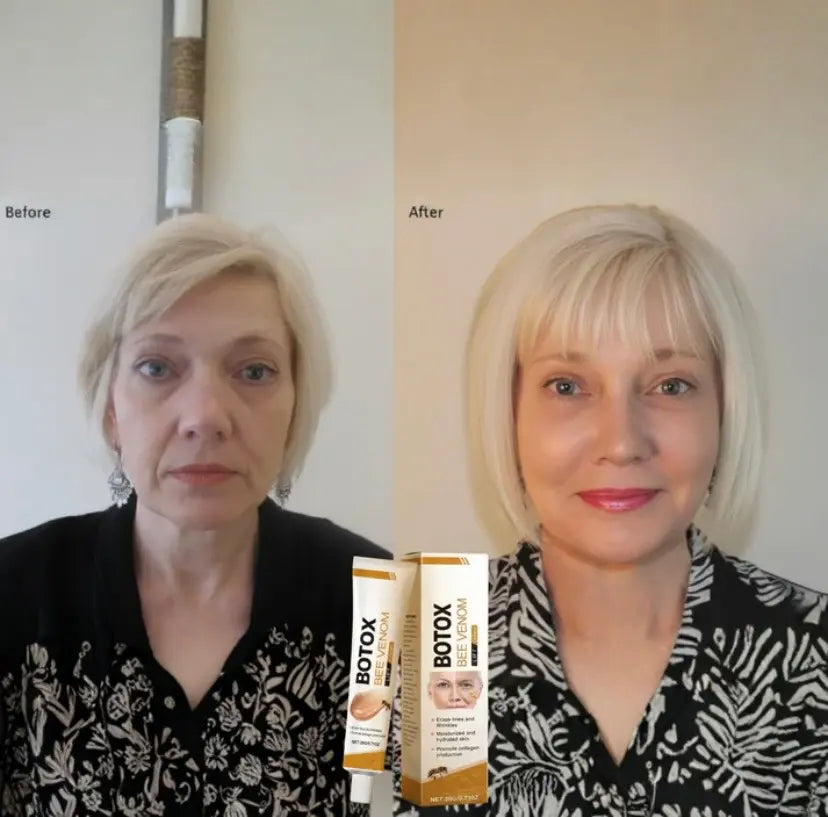 BOTOX BEE VENOM