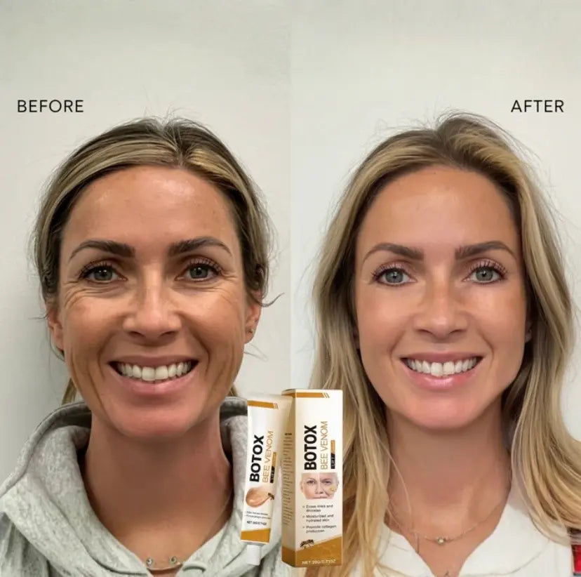 BOTOX BEE VENOM