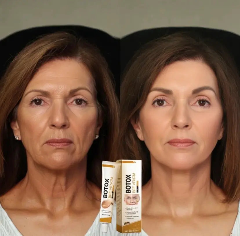 BOTOX BEE VENOM